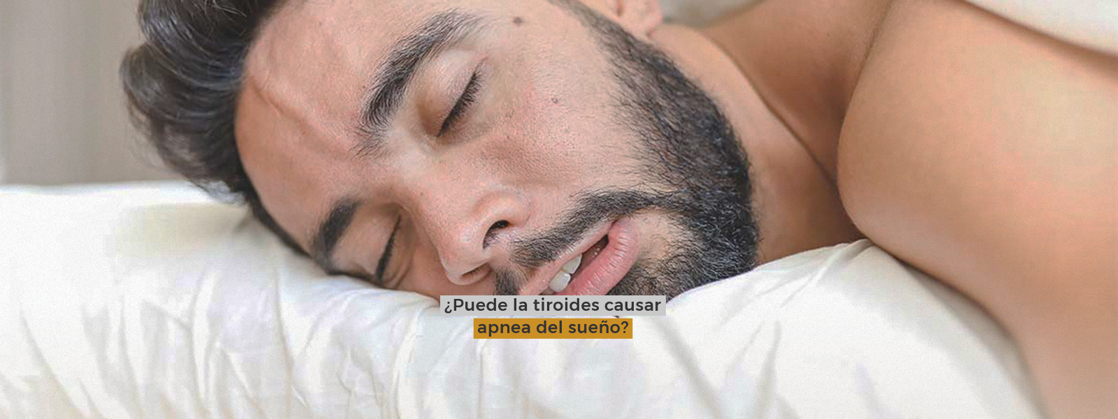 ¿Puede la tiroides causar apnea del sueño?