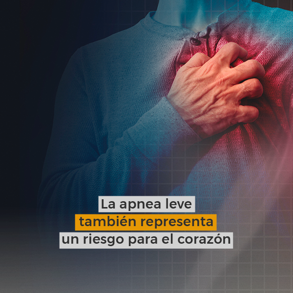 La apnea leve también representa un riesgo para el corazón